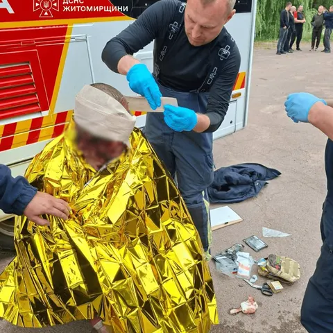 Росіяни атакували агропідприємство на Житомирщині: постраждали шестеро людей, се