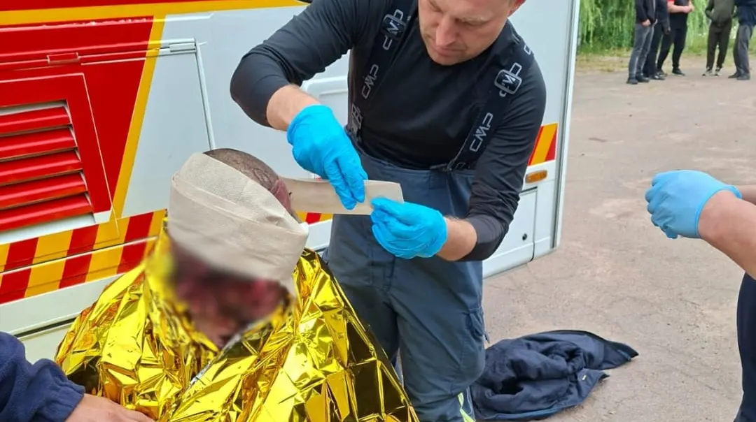 Атака на Житомирщині: шість постраждалих, серед них троє дітей