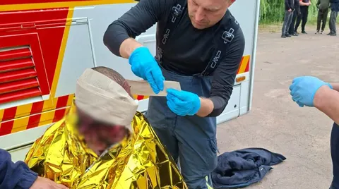 Атака на Житомирщині: шість постраждалих, серед них троє дітей