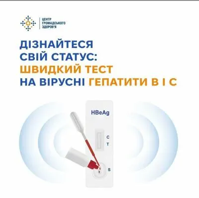 Тиждень безоплатного тестування на гепатити: у Рівненській області виявили тисячі хворих