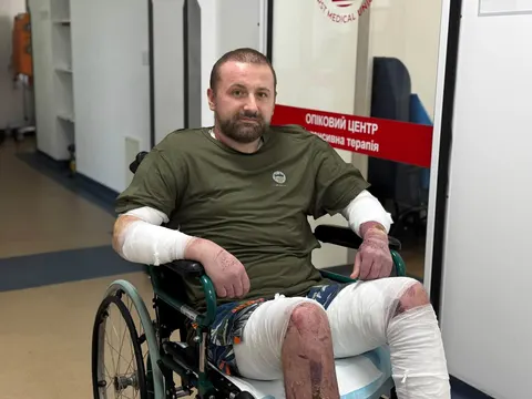 Вибух бойлера у Львові: як медики виборювали життя чоловіка з 80% опіків
