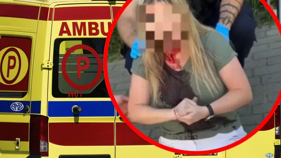 У Ґдині нападник двічі вдарив українку тростиною по голові: поліція шукає зловмисника