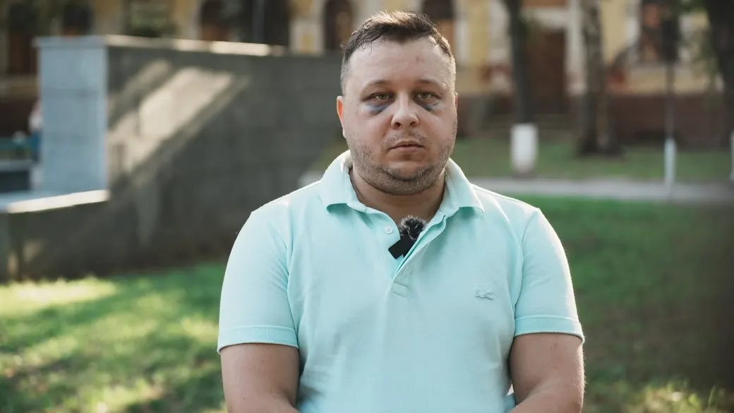 Побиття аніматора в Харкові: поліція розслідує, ТЦК заперечує