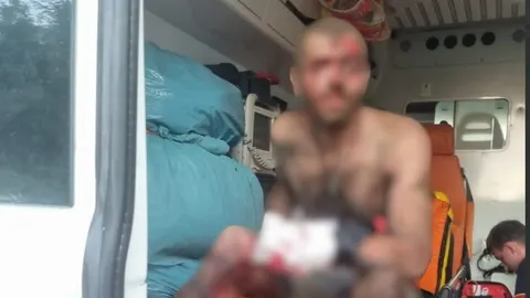 У Слатиному чоловік підірвався на вибухонебезпечному предметі: втратив руку