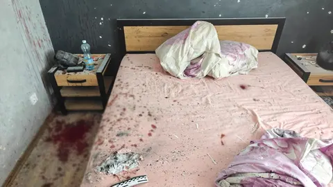 На Рівненщині через вибух гранати постраждали двоє молодих людей